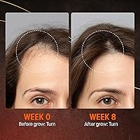 Abera Hair Growth Serum 1.69 fl oz — image 4