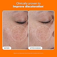 Paula's Choice 25% Vitamin C Serum, 1oz — image 4