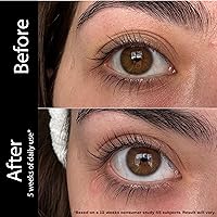 XL Lashes Lash Serum 3ml — image 5