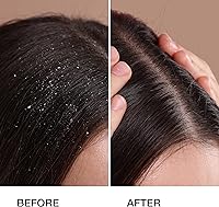 GK HAIR Anti-Dandruff Shampoo 8.5 Fl Oz — image 2