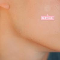 SMARTMED Ollie Belle Cover Dot Acne Care Patches, 240 Count — image 6