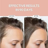 Luxe Cosmetics Hair Growth Serum 30mL — image 2