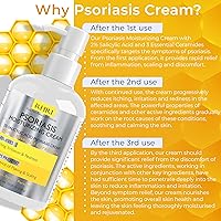 Rida Psoriasis Cream for Itchy Scalp, Face & Body, XL Size — image 4