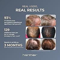 Hairmax RegrowMD Laser Hair Growth Cap — image 3