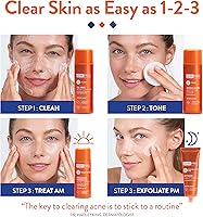 AcneFree Severe Acne 24 Hour Clearing System — image 4