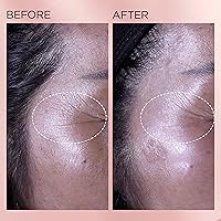 Elizabeth Arden Retinol + HPR Ceramide Rapid Skin Renewing Anti-Aging Face Serum Capsules — image 9