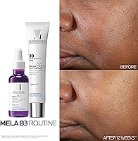 La Roche-Posay Mela B3 UV Daily Sunscreen SPF 30, 40mL — image 4