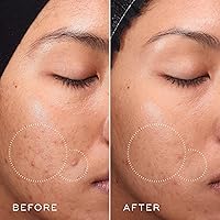 Medik8 Press and Clear Clarifying Facial Tonic 5oz — image 5