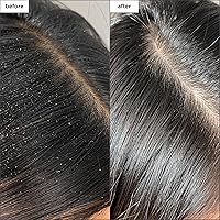 Briogeo Scalp Revival Charcoal + Tea Tree Buildup Detox Spray, 4 fl oz — image 2