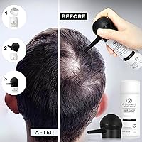 Adonis 5-in-1 Hair Fiber Kit (Black) — image 6