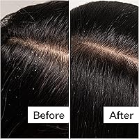 ACT+ ACRE Cold Processed Scalp Detox Oil 3oz — image 6