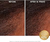 Moroccanoil Revitalizing Scalp Tonic Treatment for Thinning Hair 3.88oz — image 2