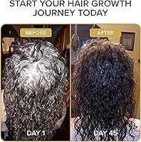 Shedavi Iconic Vegan Hair Serum 2oz — image 7