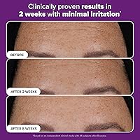 Paula’s Choice Pro Retinaldehyde Dual-Retinoid Advanced Treatment Serum 3.53oz — image 5