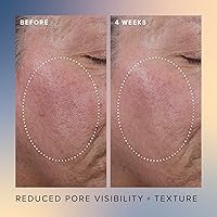 Farmacy Honey Glow Serum 17% AHA + BHA Exfoliant (30mL) — image 3