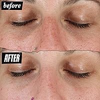 Kiehl's Clearly Corrective Dark Spot Serum 0.5oz — image 5