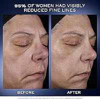 Lancôme Génifique Ultimate Dual Recovery Face Serum 1oz — image 4