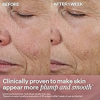 StriVectin Anti-Wrinkle Peptide Plump Line Filling Bounce Face Serum 6.38oz — image 6