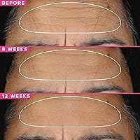 Farmacy Retinol Serum 1% Vitamin A - 30ml — image 3