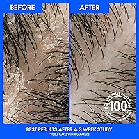 Head & Shoulders Itchy Scalp Care Dandruff Shampoo, 32.1 Fl Oz Twin Pack — image 3