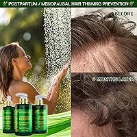 Botanical Scalp Soothing Hair Treatment 4.2 Fl Oz — image 5