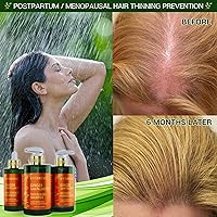 Botanical Hair Growth Treatment Ginger Saw Palmetto Hair Oil 4.2oz — image 6