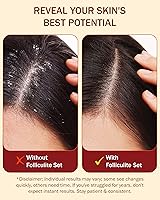 e70 Folliculitis Treatment Leave-On Scalp Serum 2 fl oz — image 5
