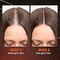 Abera Hair Growth Serum 1.69 fl oz — image 6