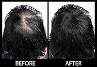 MAXX Pro-Series Volumizing Hair Fibers – 25g (Black) — image 6