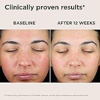 EltaMD UV Skin Recovery Face Sunscreen SPF 50 — image 6